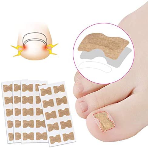 Patch de correction des ongles,50 PCS autocollants de soins des pieds autocollant de correction d'ongle d'orteil pédicure professionnelle autocollants de correction d'ongle pour hommes femmes